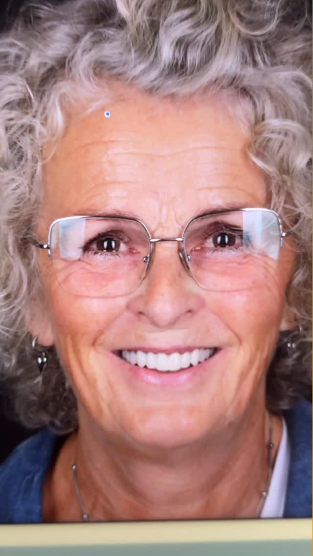 Patient result: New smile