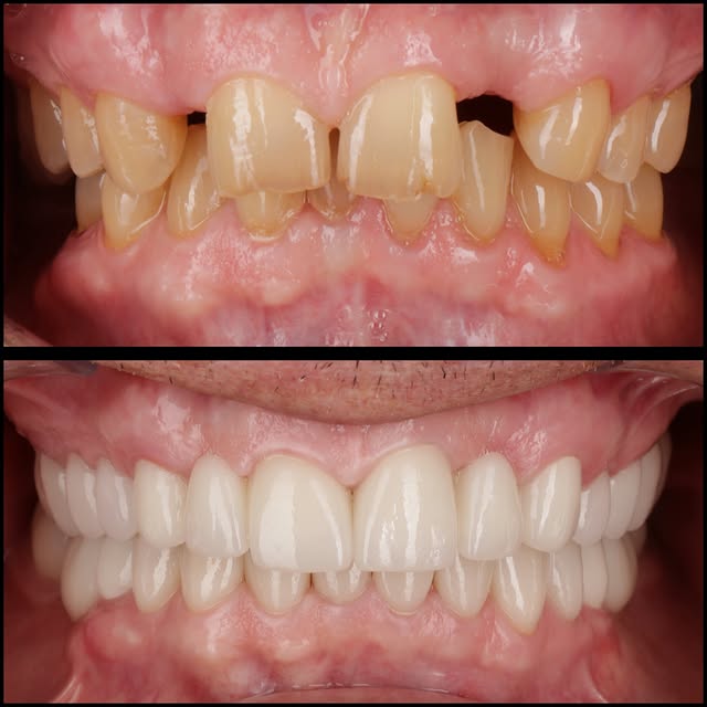 New smile new life